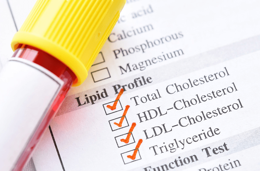 آزمایش پنل لیپیدی (LDL,HDL)