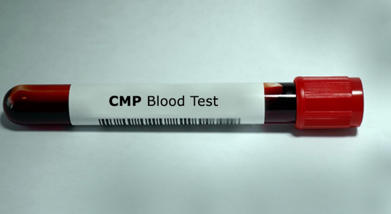 آزمایش پنل متابولیک جامع (CMP)