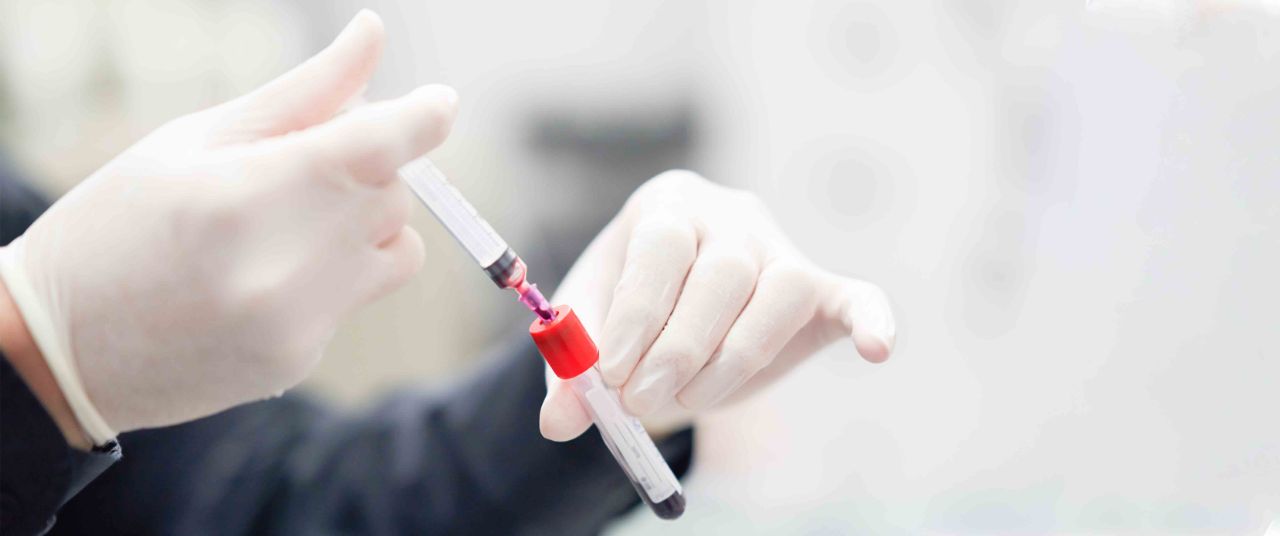 10 آزمایش خون برای آگاهی از سلامتی
