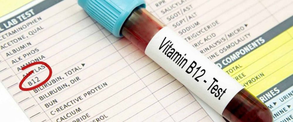 آزمایش ویتامین  B12