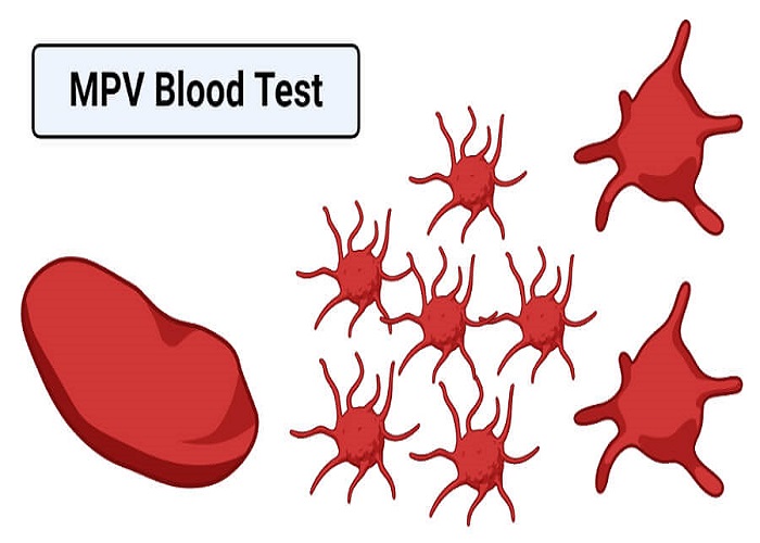 آزمایش خون MPV چه زمان‌هایی باید انجام شود