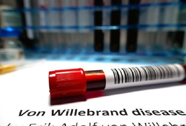 بیماری فون ویلبراند (Von Willebrand Disease)